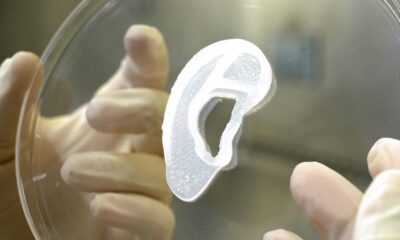 Implantan Por Primera Vez, Oreja Impresa En 3D Hecha Con Células Del Paciente Aurinovo, La Oreja Impresa En 3D  Https://Larevistadelsureste.com