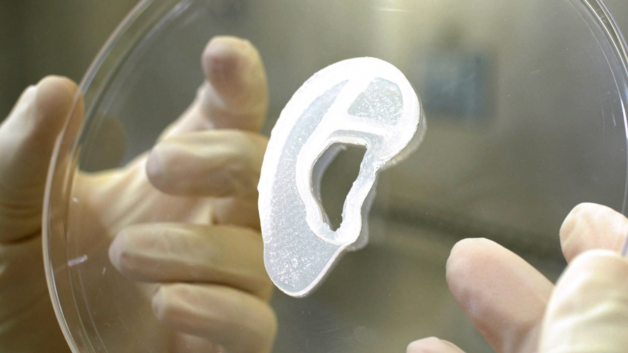 Implantan por primera vez, oreja impresa en 3D hecha con células del paciente
