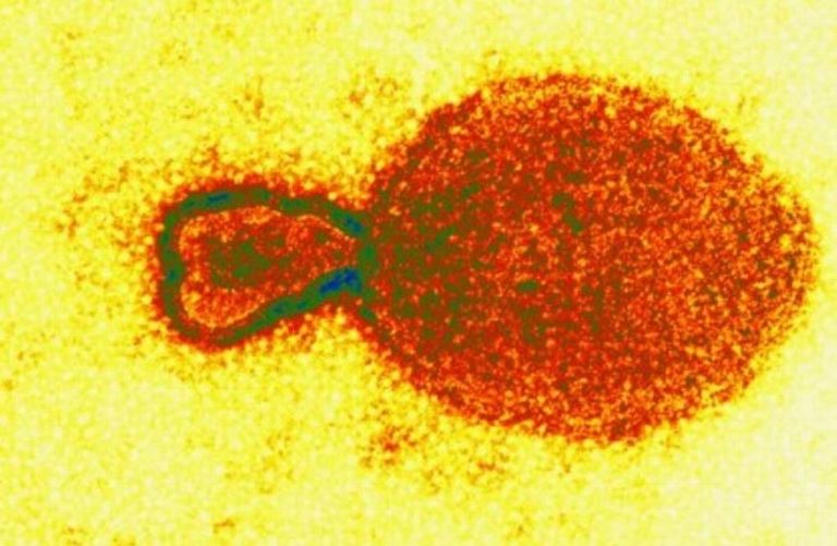 China detecta 35 casos de Henipavirus, un nuevo virus de origen animal