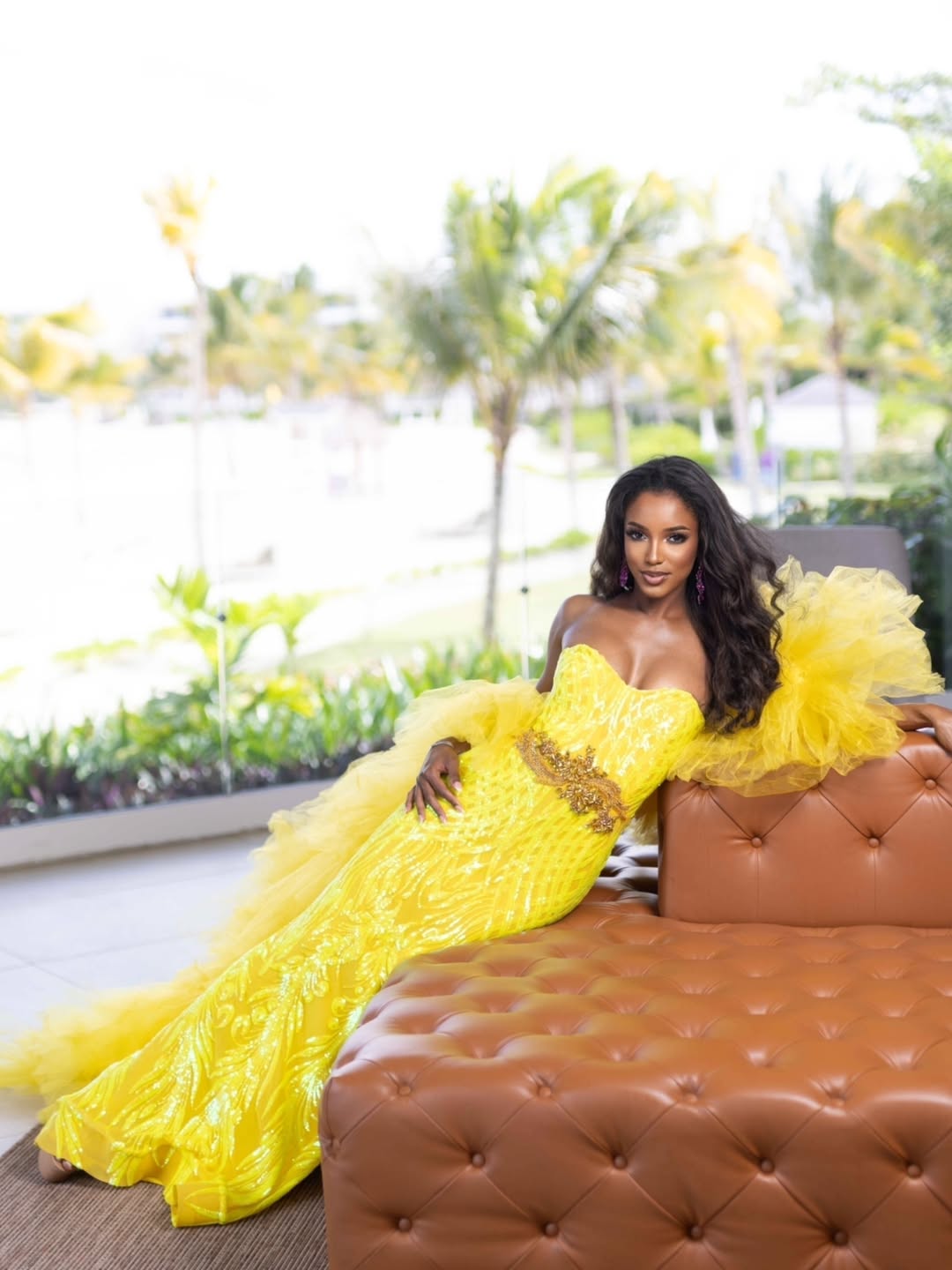 Miss Jamaica Regresara A Su Pais Para Continuar Su Recuperacion Tras Grave Accidente En Miss Universo