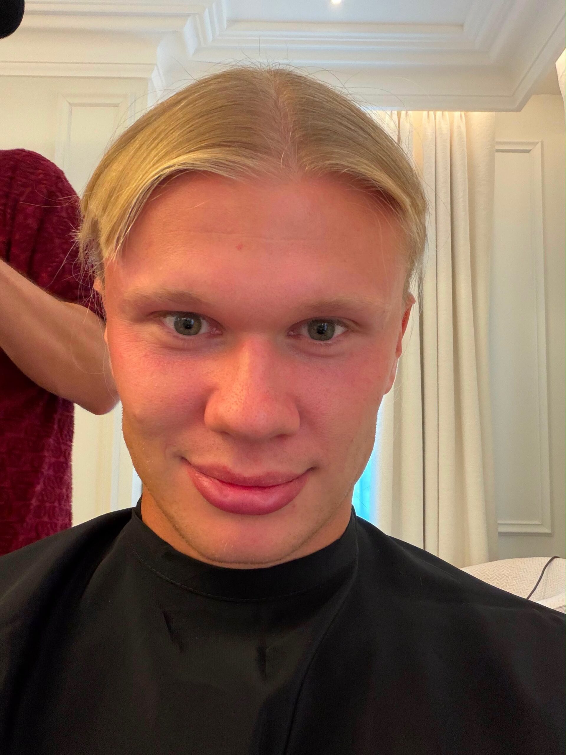 Selfie En Primer Plano De Erling Haaland Luciendo Su Nuevo Corte De Pelo Estilo Hongo Tras Cortarse La Melena Antes Del Proceso Final De Rapado.