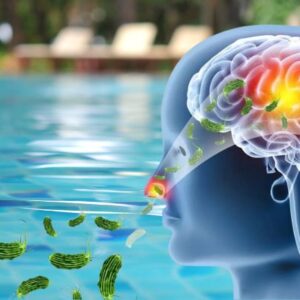 Ilustración Médica Que Muestra La Cabeza Humana En Perfil Transparente, Ilustrando Cómo Microorganismos Ingresan Por La Nariz Desde El Agua De Una Piscina Hacia El Cerebro.