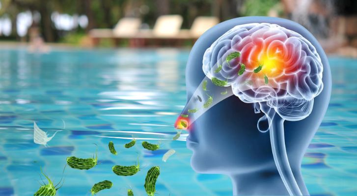 Ilustración Médica Que Muestra La Cabeza Humana En Perfil Transparente, Ilustrando Cómo Microorganismos Ingresan Por La Nariz Desde El Agua De Una Piscina Hacia El Cerebro.